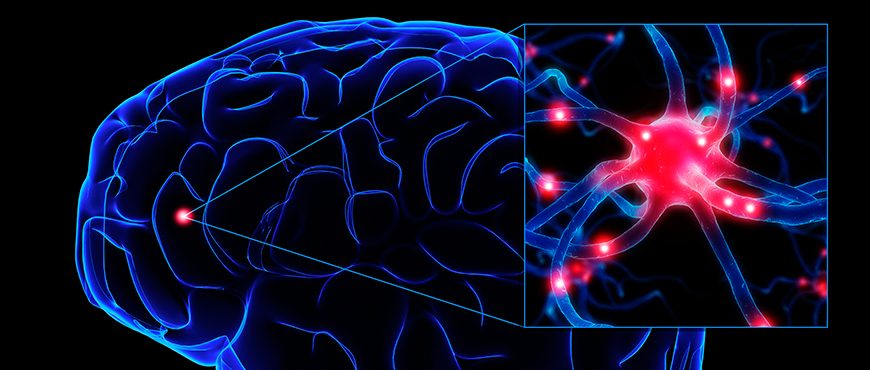 Epilepsia