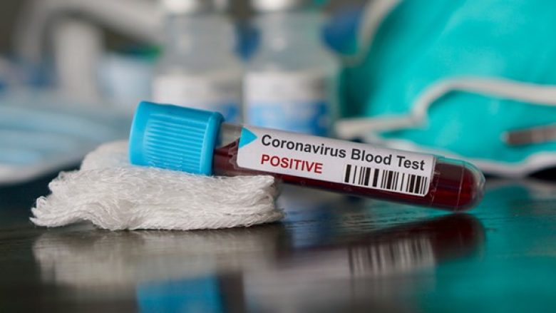 Koronavirus-testi
